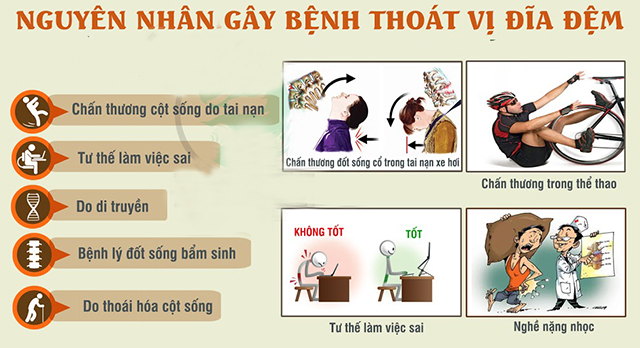 Ghế massage hỗ trợ điều trị thoát vị đĩa đệm