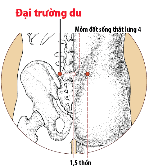 Đau lưng và những hậu quả nghiêm trọng đằng sau nó
