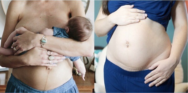 Làm sao để bụng nhỏ sau khi sinh?